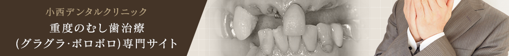 重度のむし歯治療（グラグラ・ボロボロ）専門サイト